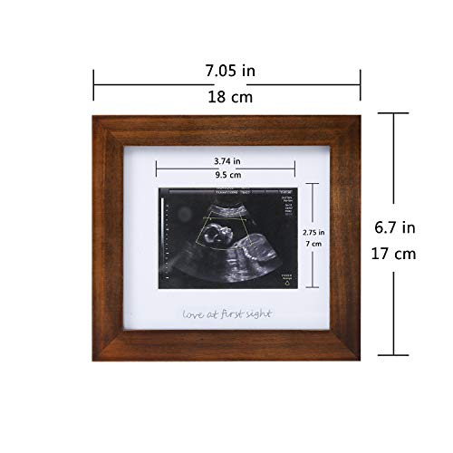 Baby Sonogram Photo Frame - First Ultrasound Picture Frame & Keepsake