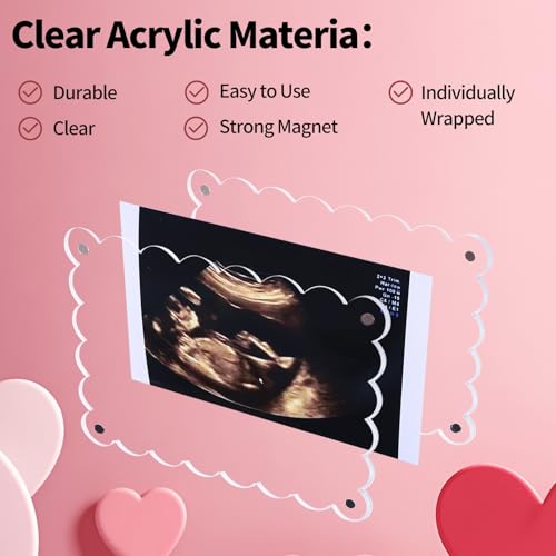 Magnetic Clear Acrylic Baby Ultrasound Frame with Scalloped Edges