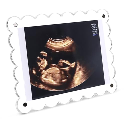 Magnetic Clear Acrylic Baby Ultrasound Frame with Scalloped Edges