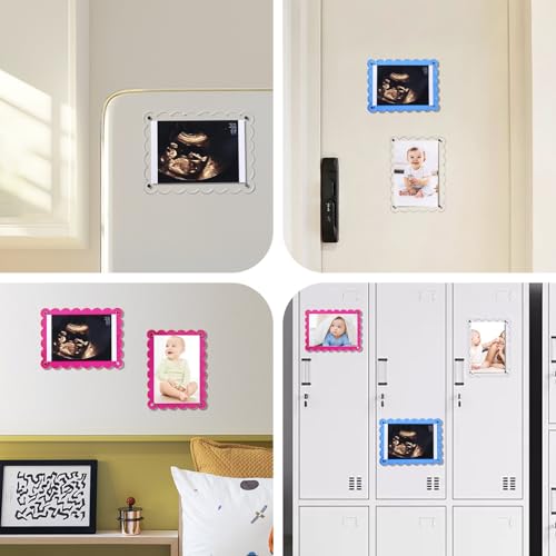 Magnetic Clear Acrylic Baby Ultrasound Frame with Scalloped Edges