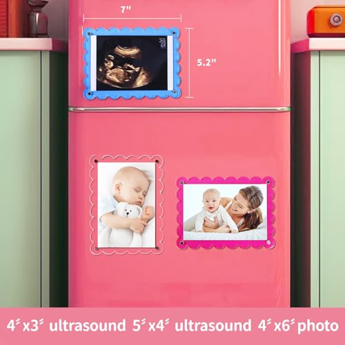 Magnetic Clear Acrylic Baby Ultrasound Frame with Scalloped Edges