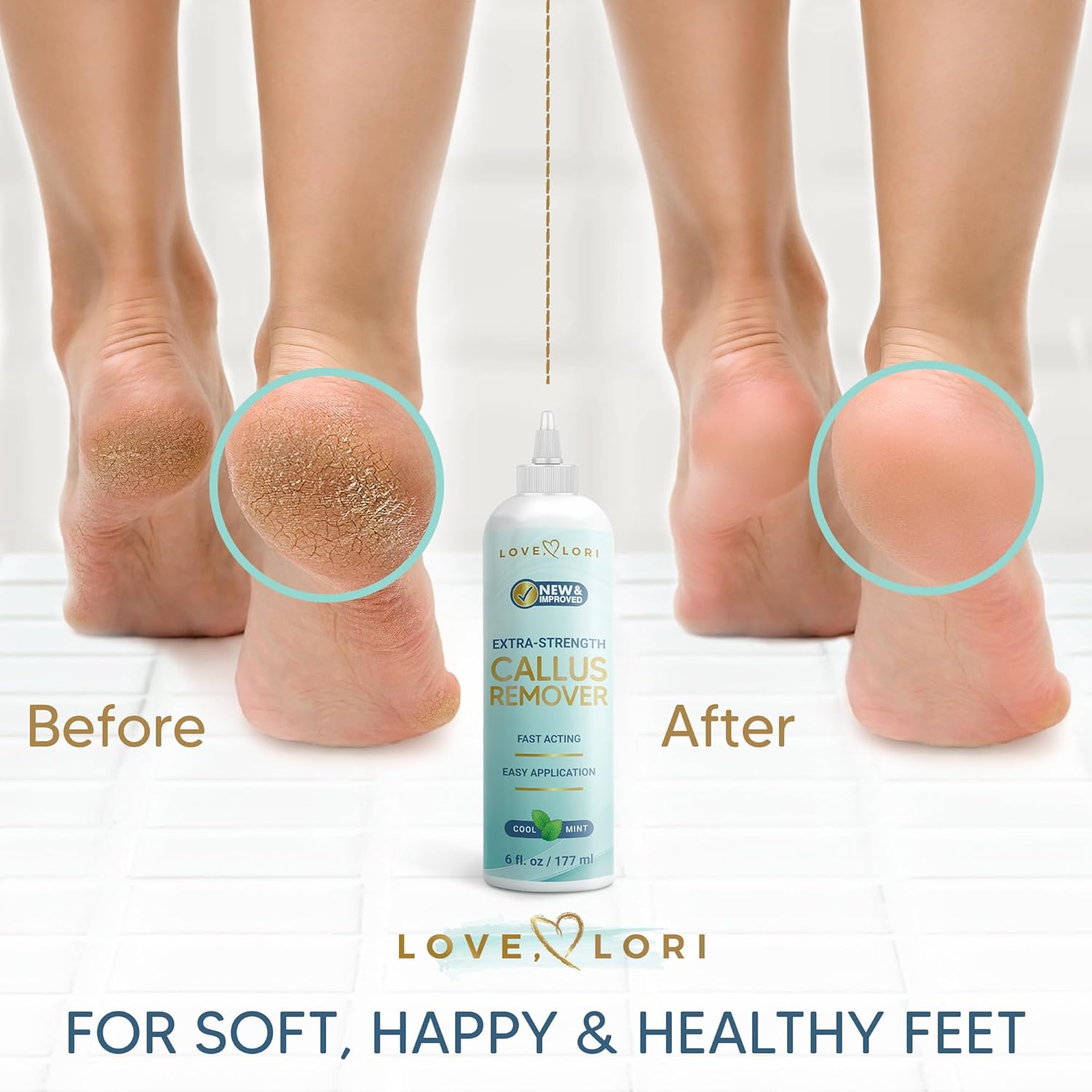 Skiennix Callus Remover Gel - Extra Strength Foot Care Scrubber for Smooth Feet | 6oz