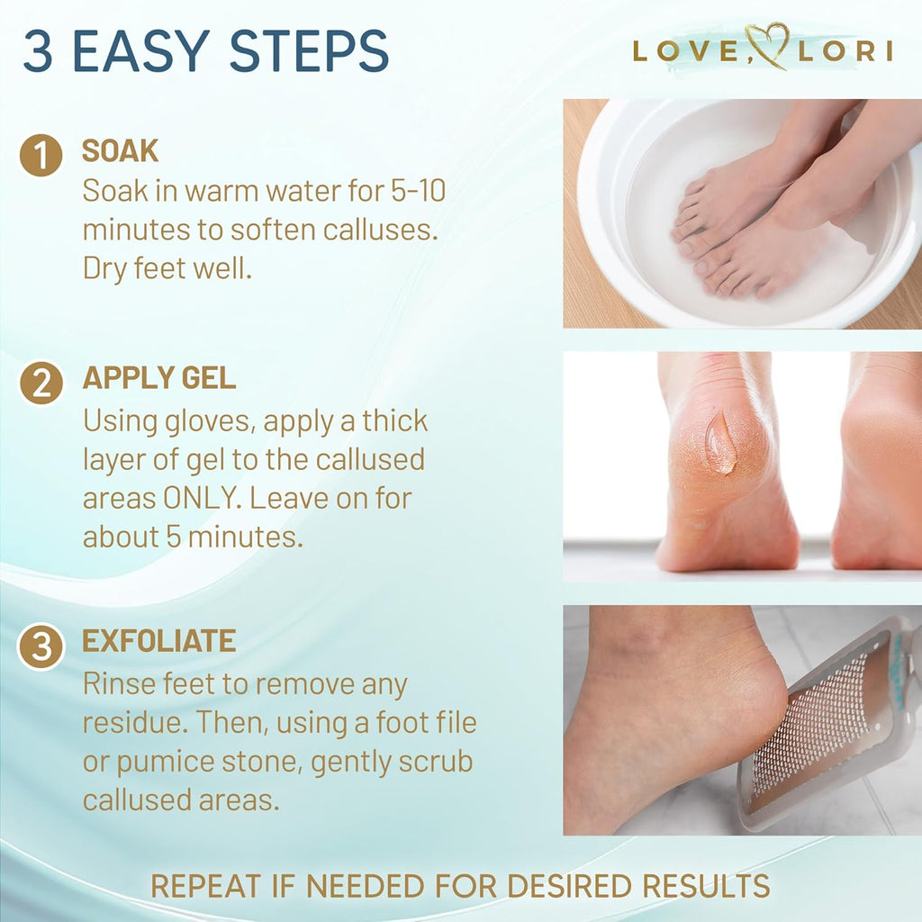 Skiennix Callus Remover Gel - Extra Strength Foot Care Scrubber for Smooth Feet | 6oz