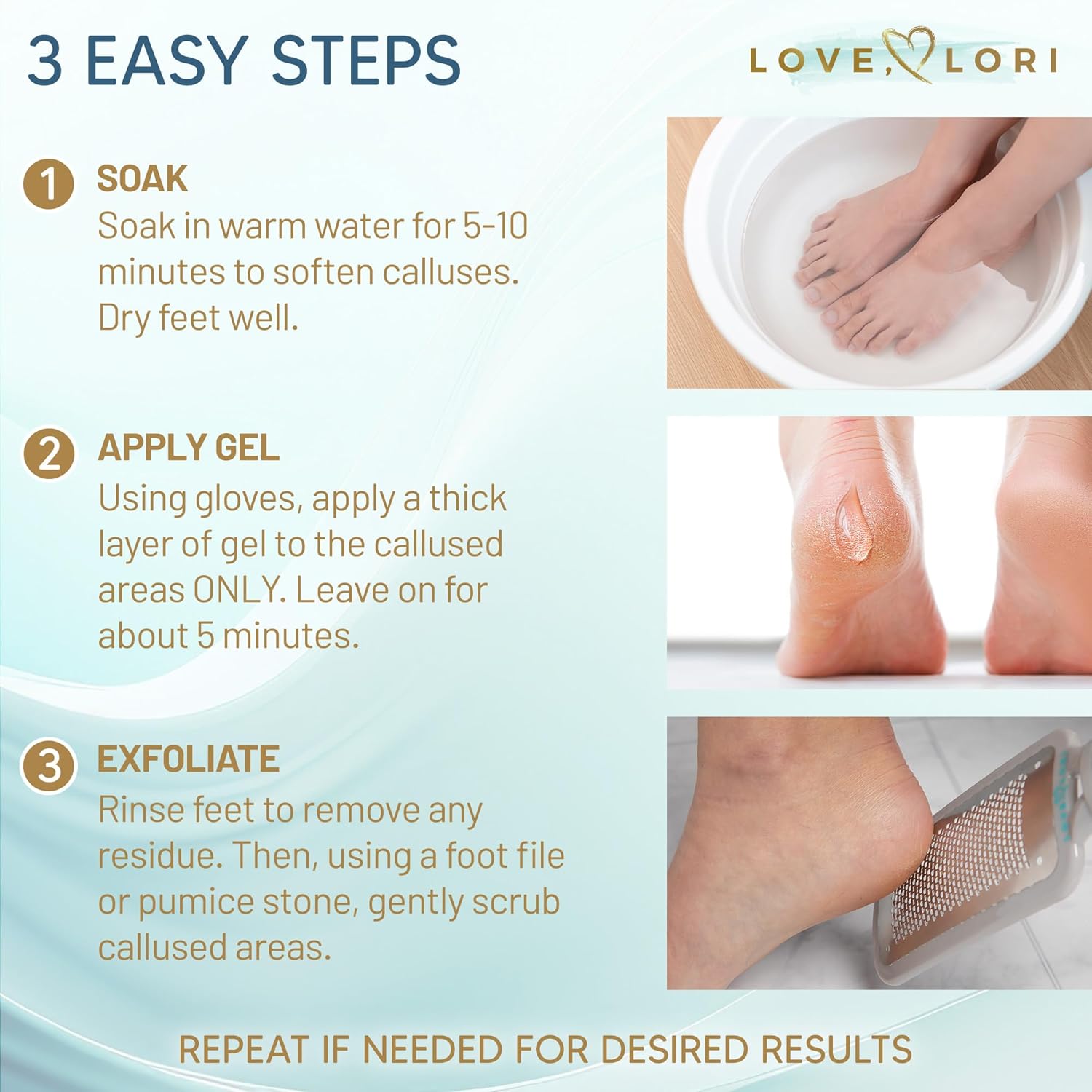 Skiennix Callus Remover Gel - Extra Strength Foot Care Scrubber for Smooth Feet | 6oz