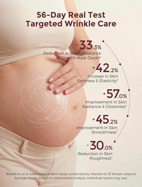 Momcozy Stretch Mark Cream - Pro-Collagen Belly Firming Moisturizer with Facial-Grade Peptides | 5.29 oz (150g)