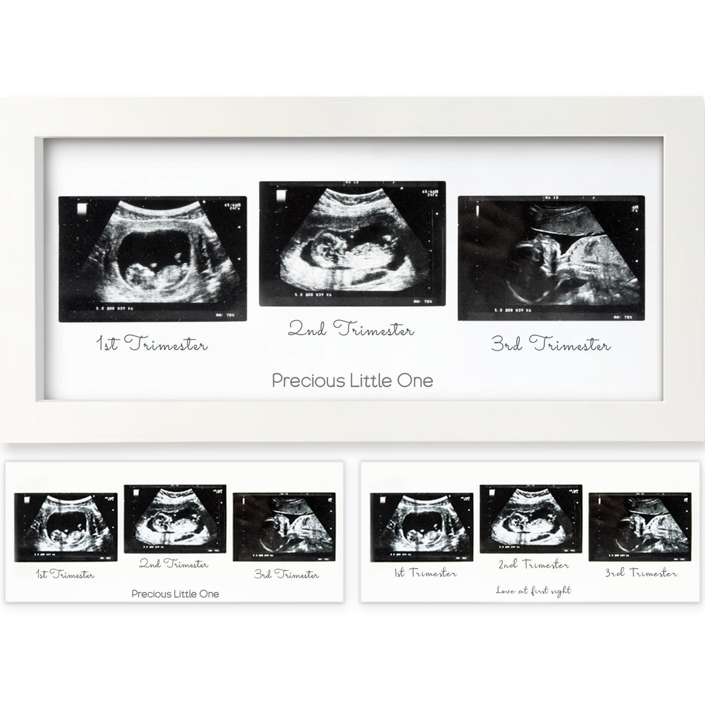 KeaBabies Baby Sonogram Picture Frames - Trio Ultrasound Picture Frames, First Time Mom Gift, Cute Pregnancy Reveal Photo Frame, Baby Gender Reveal Gift, Newborn Nursery Decor (Alpine White)
