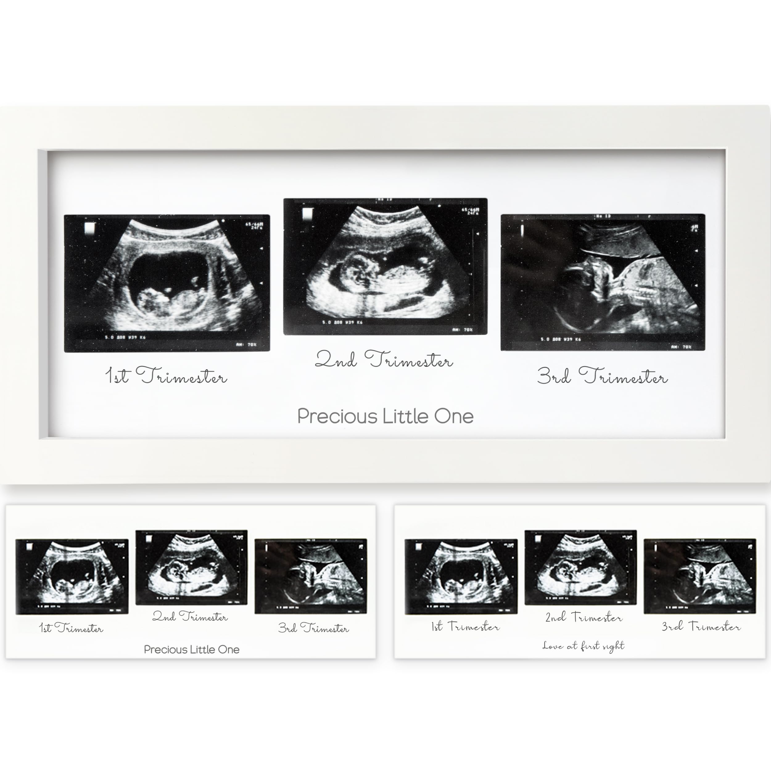 KeaBabies Baby Sonogram Picture Frames - Trio Ultrasound Picture Frames, First Time Mom Gift, Cute Pregnancy Reveal Photo Frame, Baby Gender Reveal Gift, Newborn Nursery Decor (Alpine White)